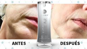 Neora antes y despues 1
