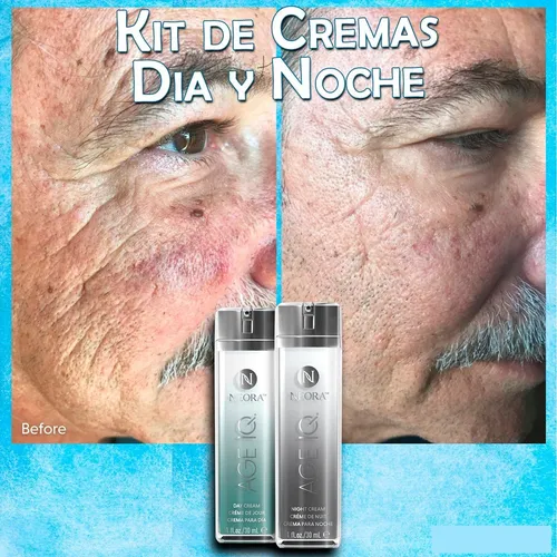 Neora antes y despues 2